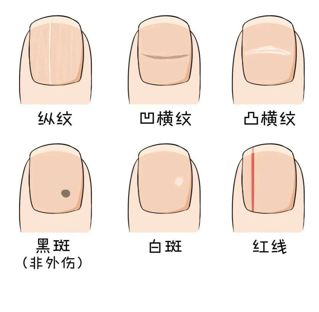 broken image